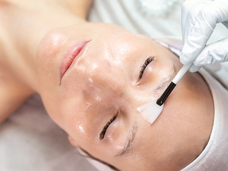 Limpieza Facial Profunda